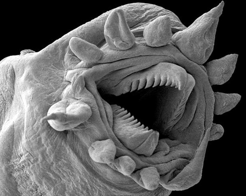16-terryfying-images-from-the-microscope